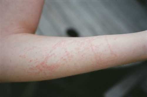 Медузы черного моря: чем питаются, сколько живут, ядовитые и опасные виды для человека, описание, можно ли их есть